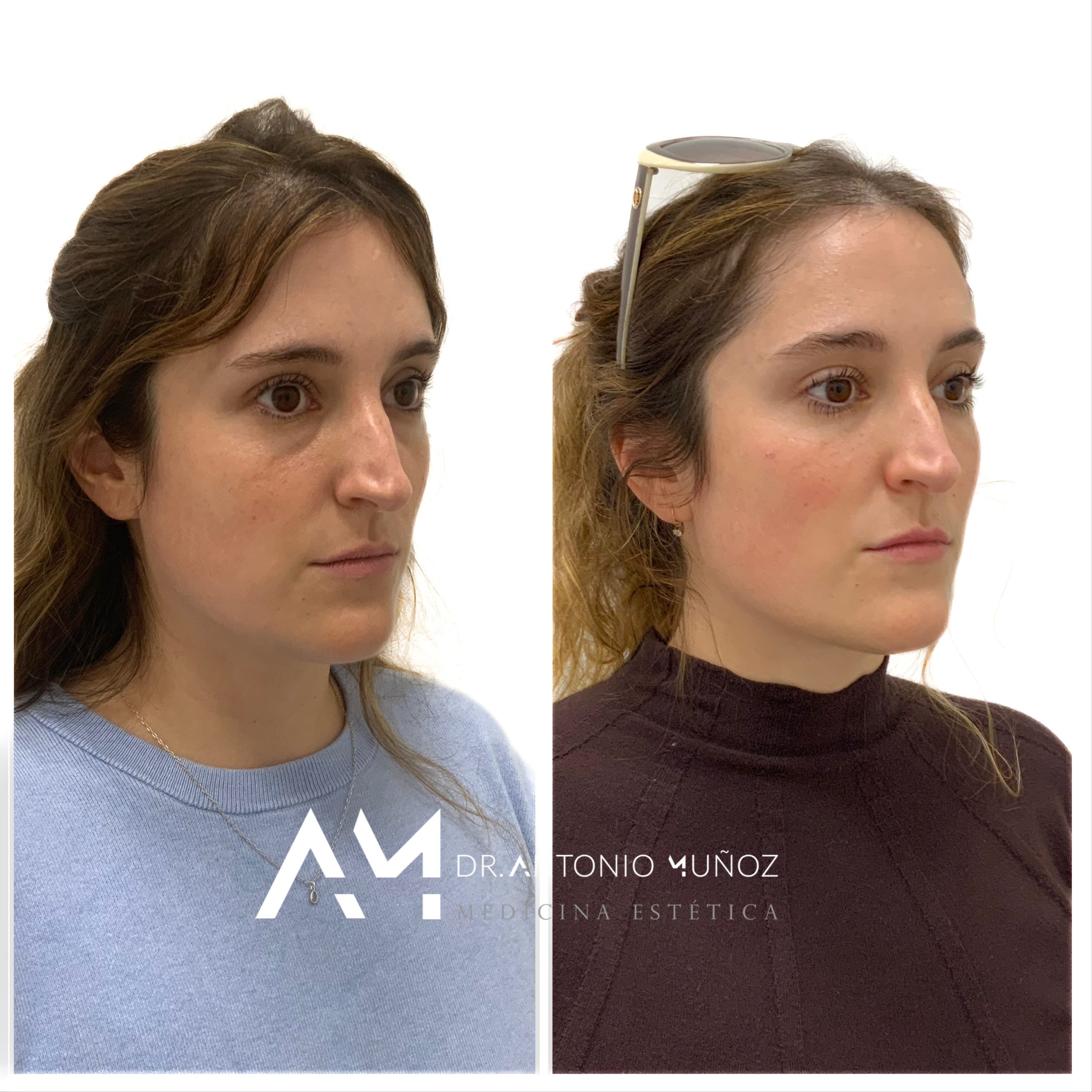 definición del arco mandibular