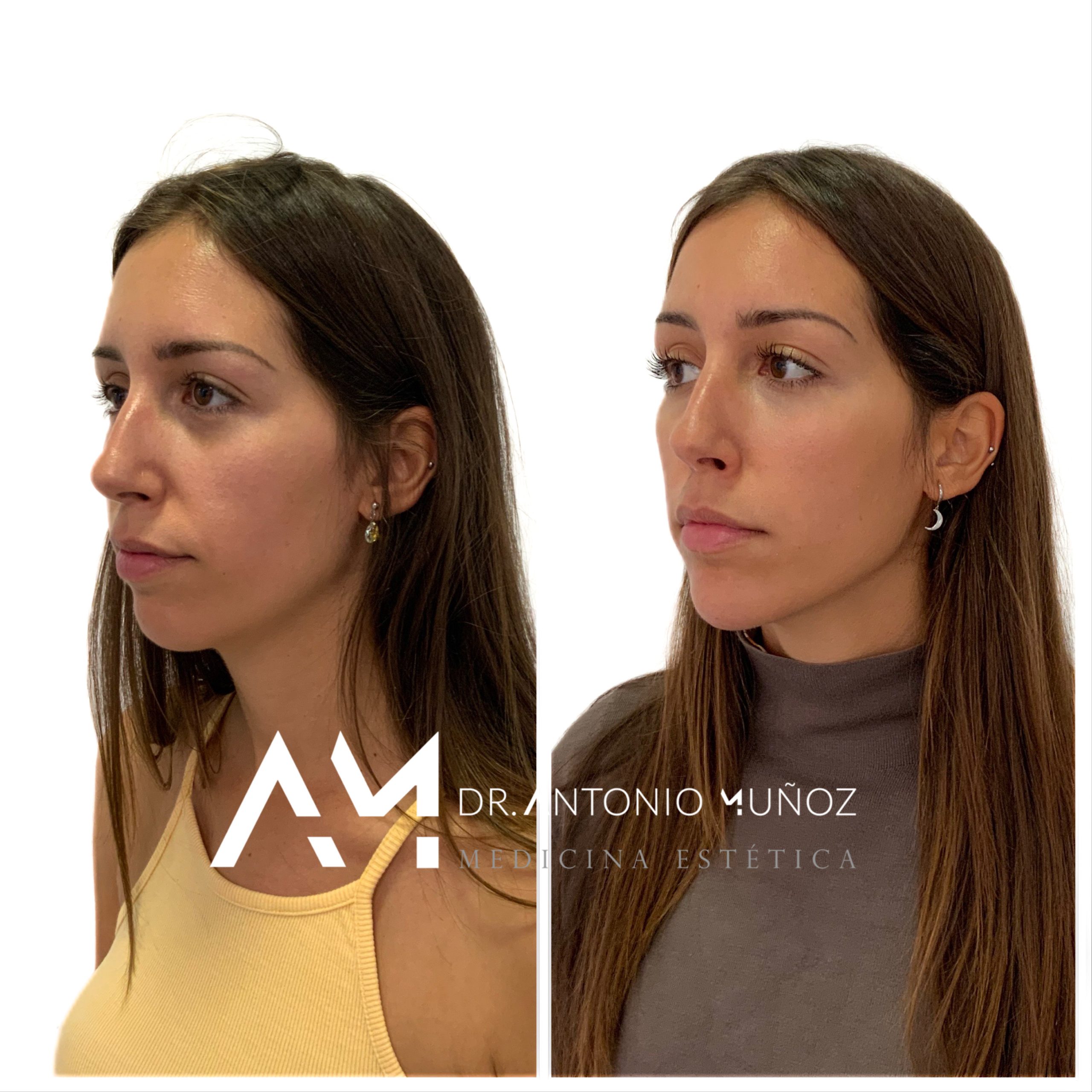definición del arco mandibular