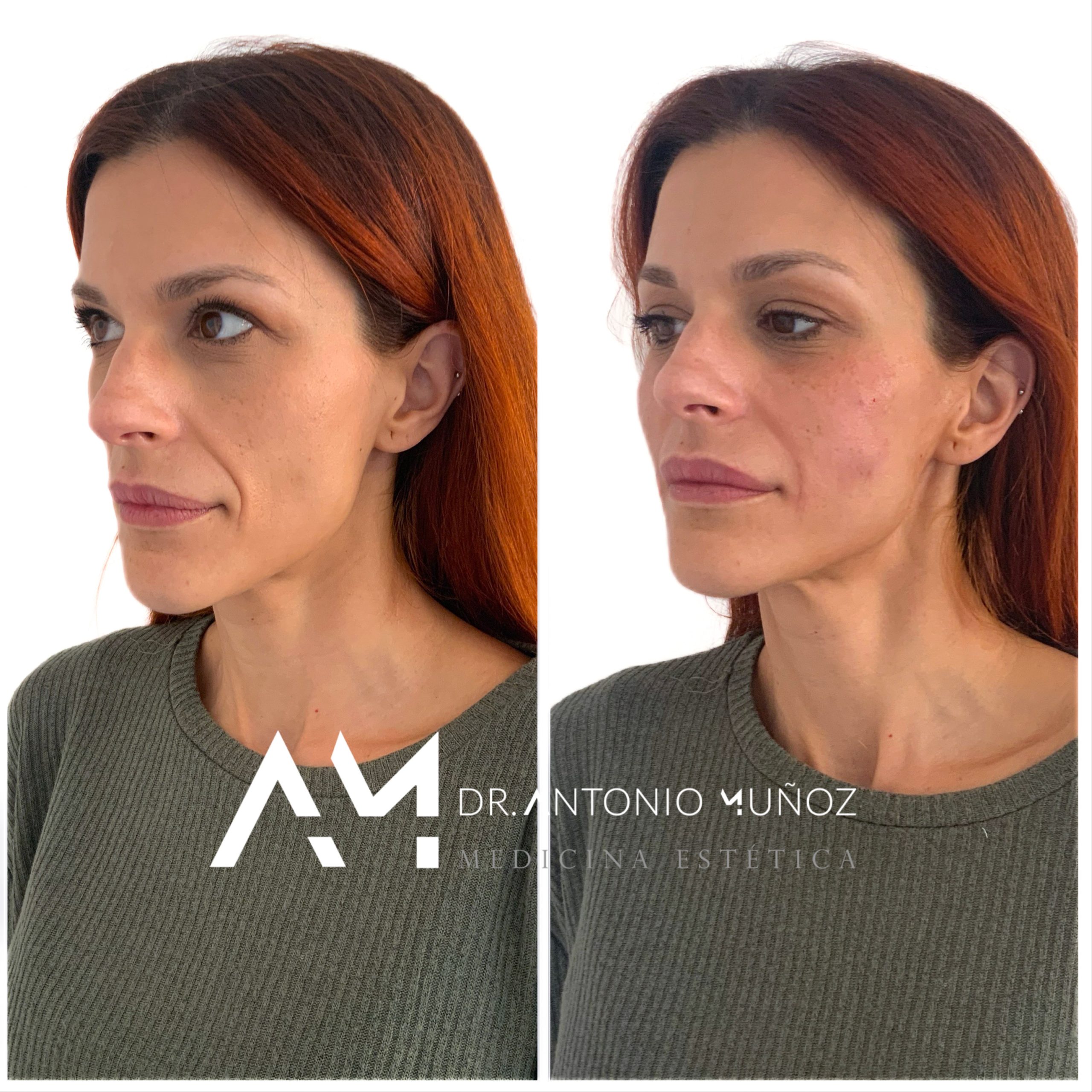 Full Face en Alicante