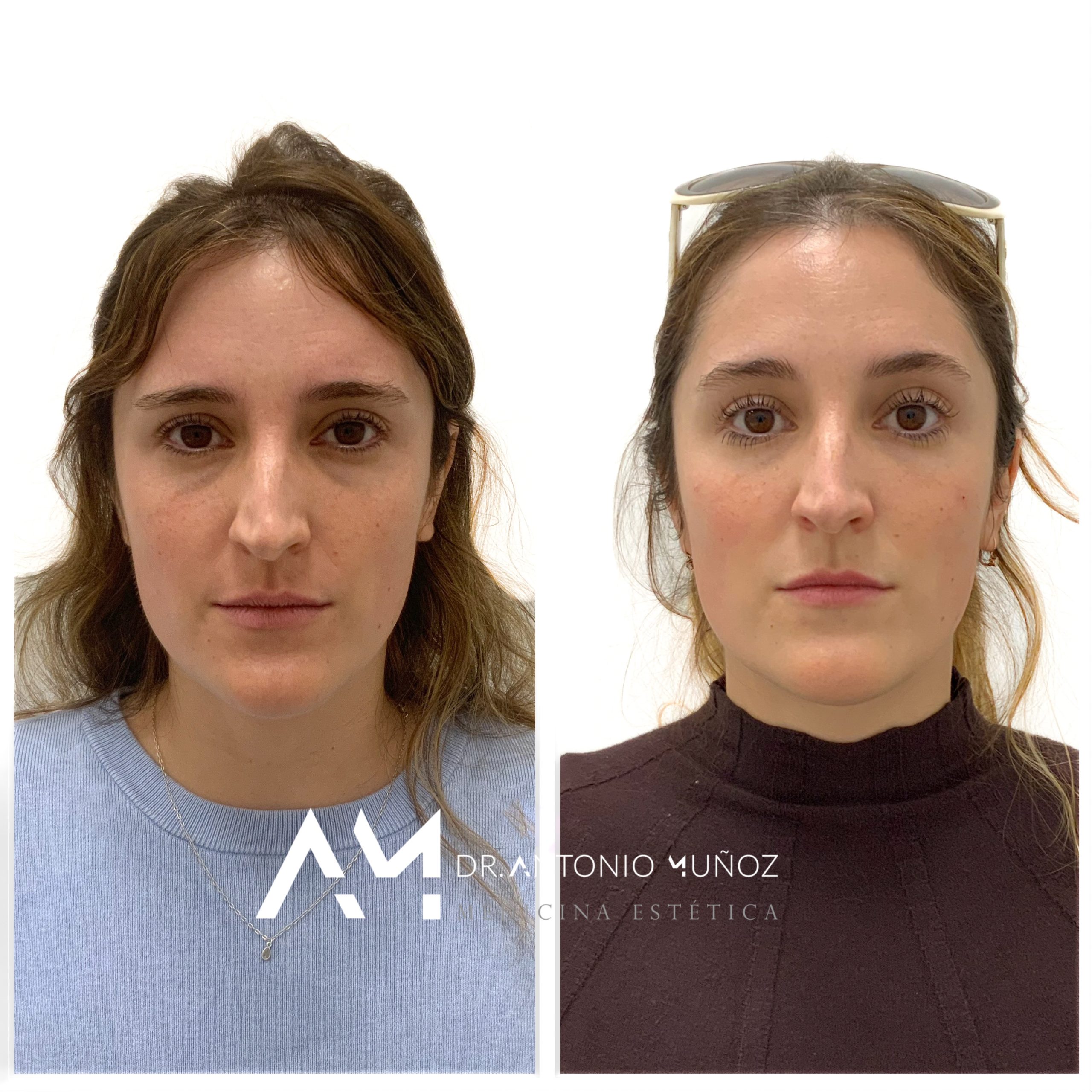 Full Face en Alicante