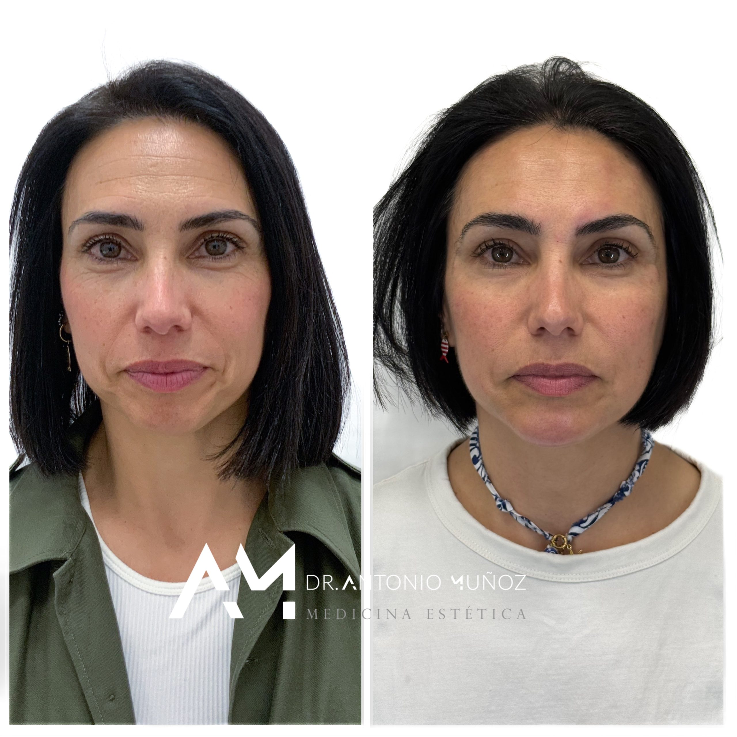 Full Face en Alicante