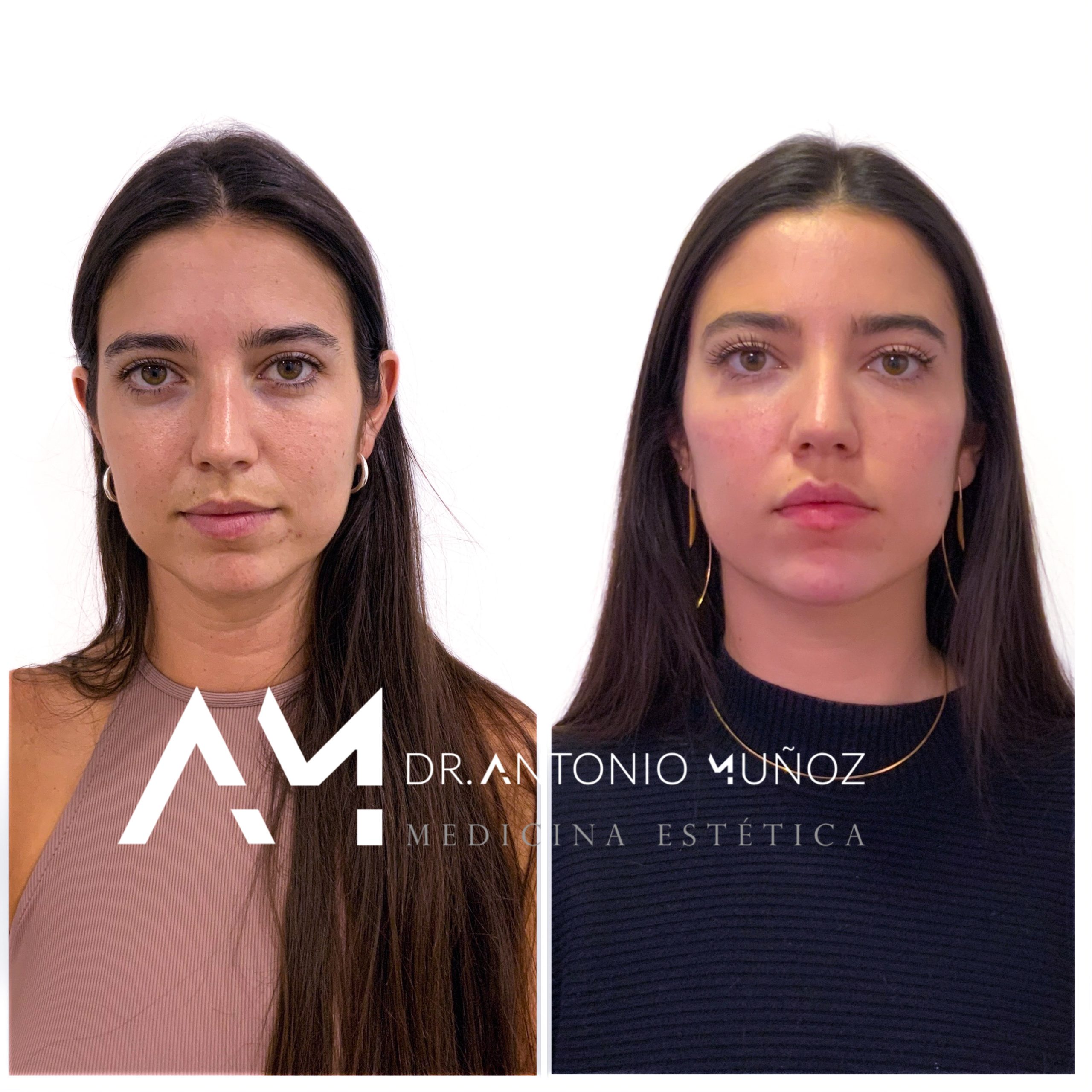 Full Face en Alicante