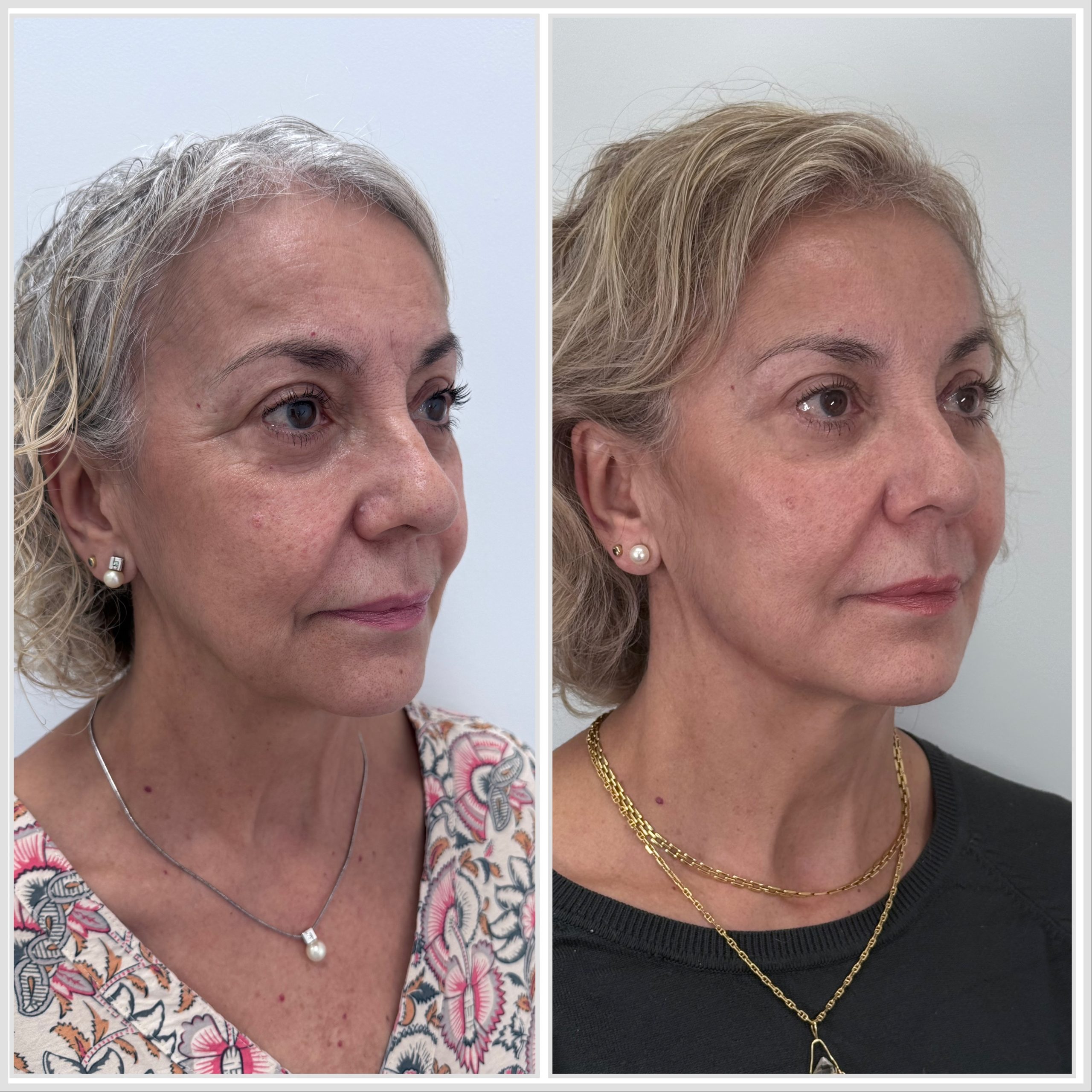 Full Face en Alicante