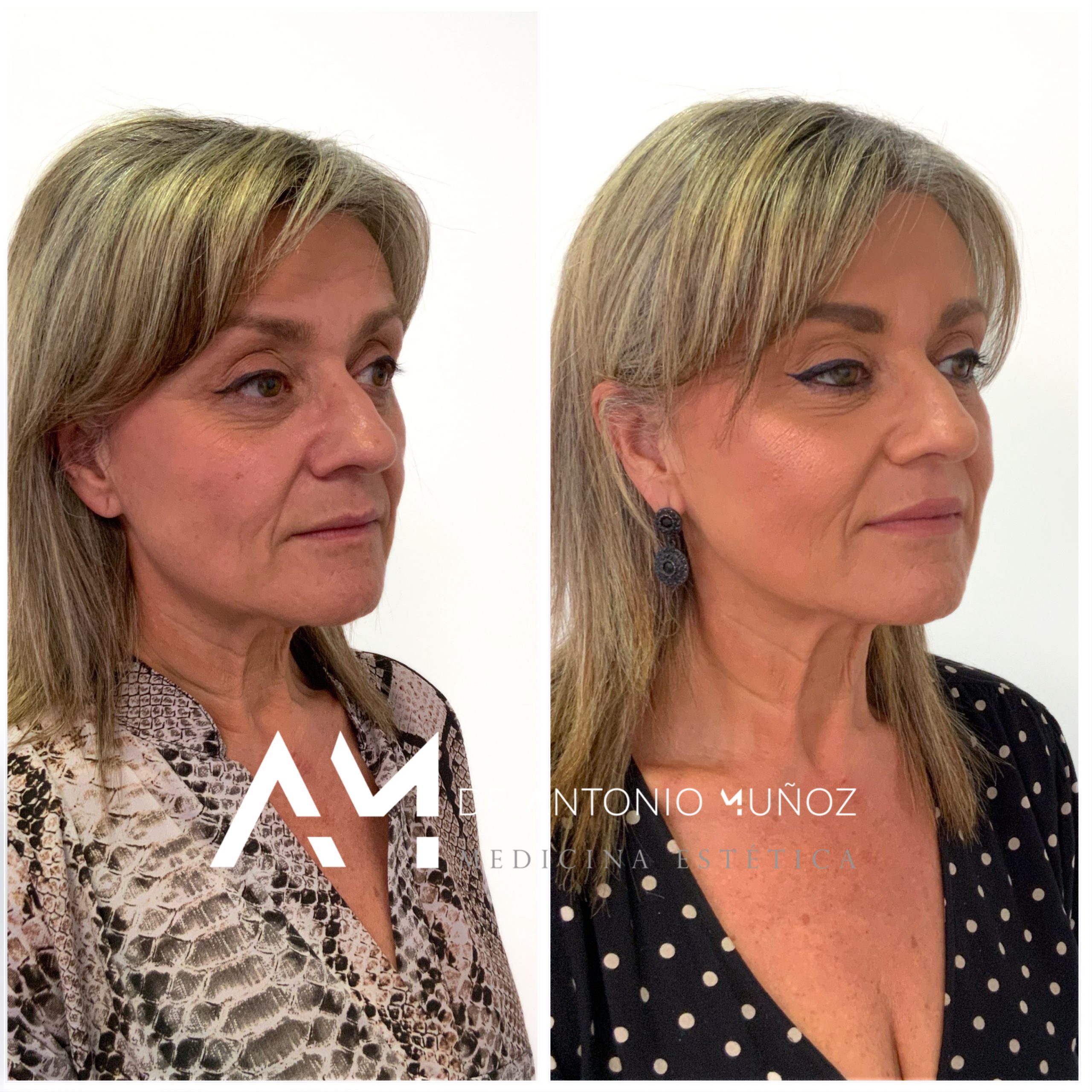 Full Face en Alicante