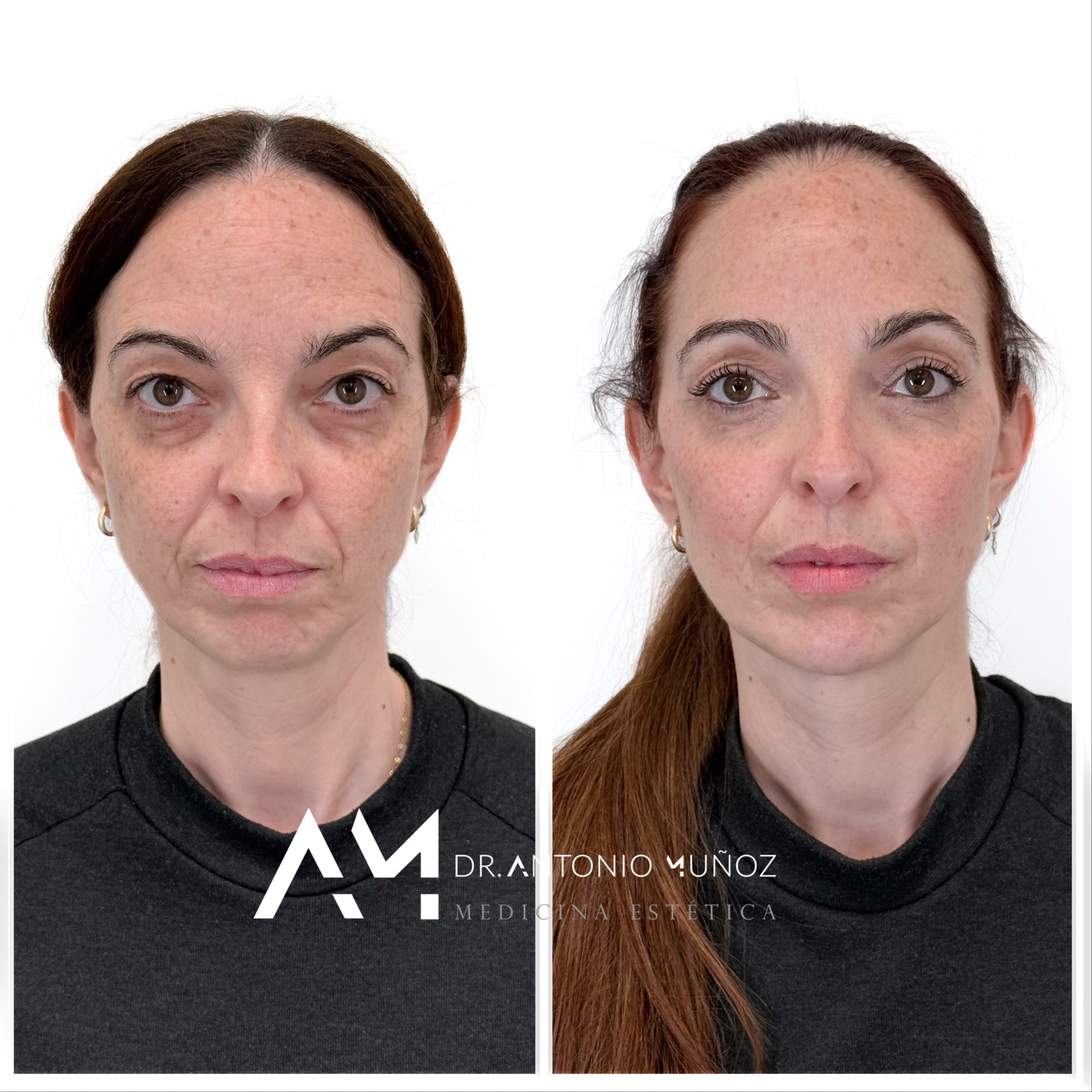 Full Face en Alicante
