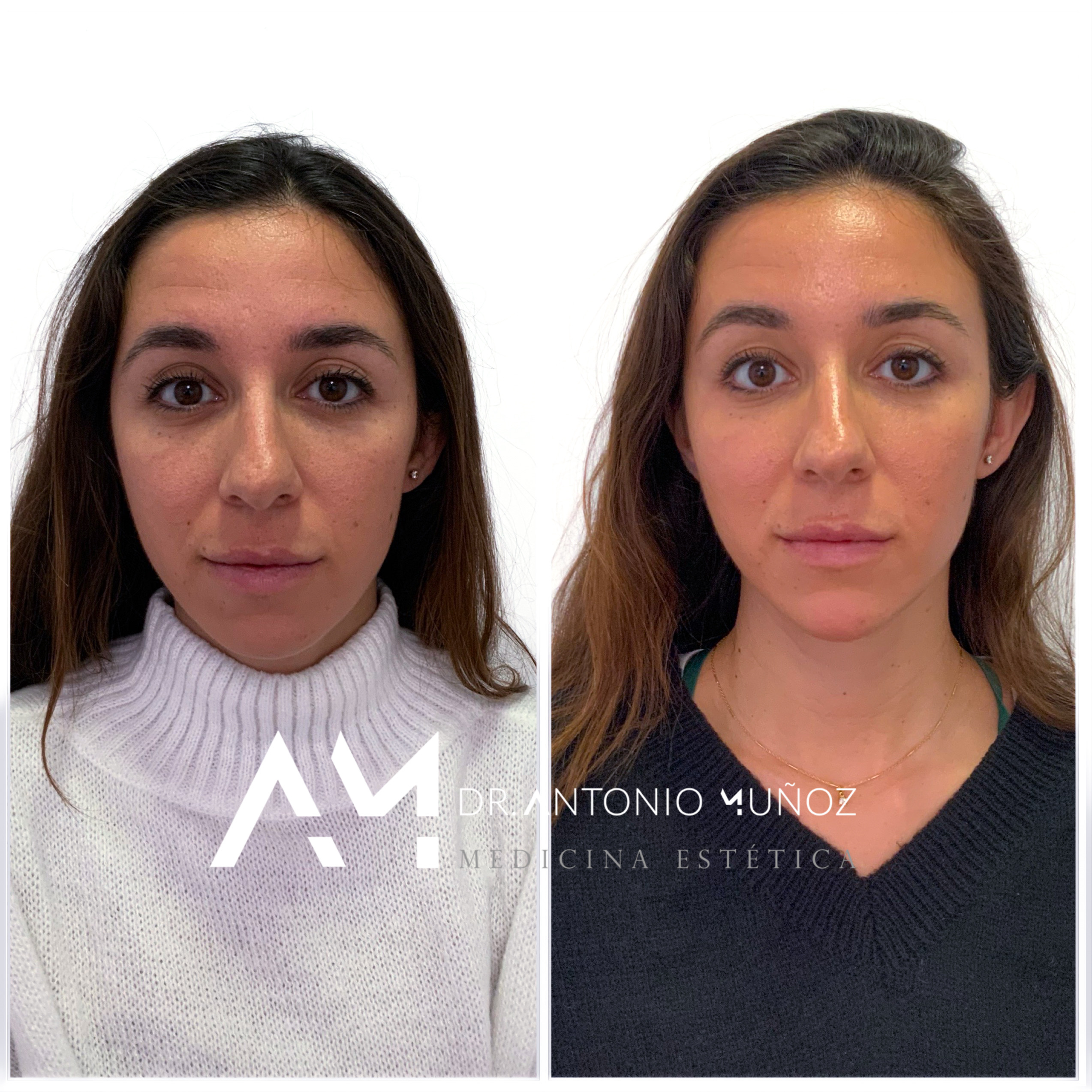 Full Face en Alicante