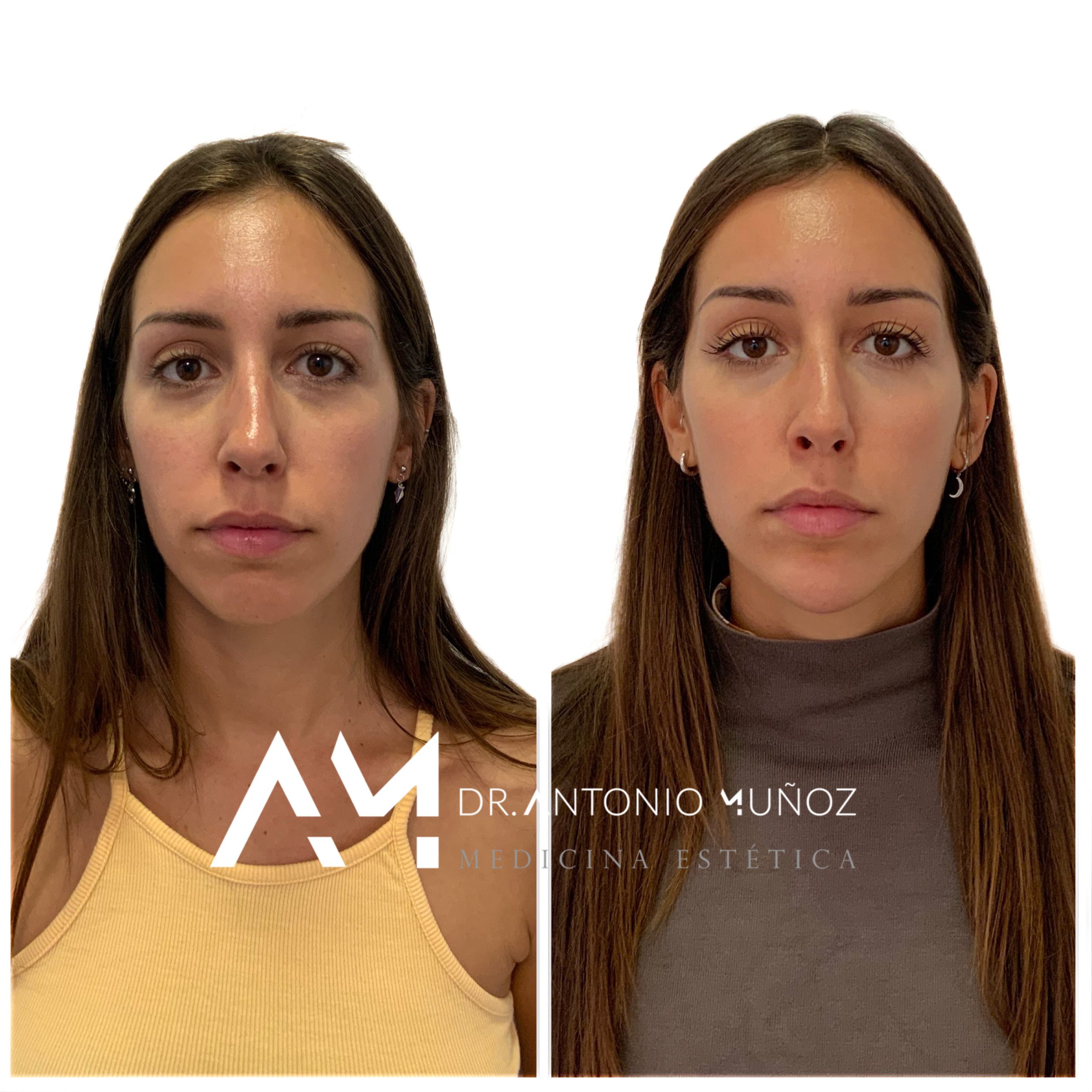 Full Face en Alicante